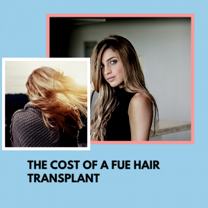 hair transplant side effects