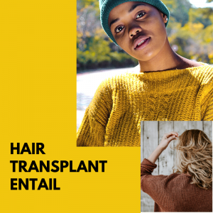 types of hair transplant