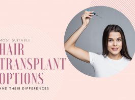 Hair Transplant Options